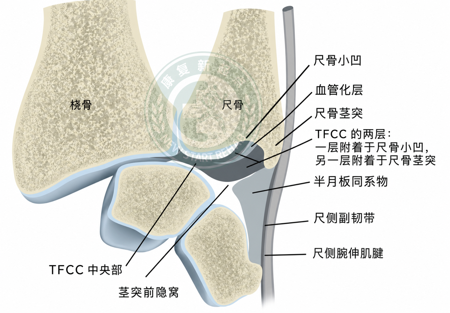 TFCC 尺骨小凹附着图