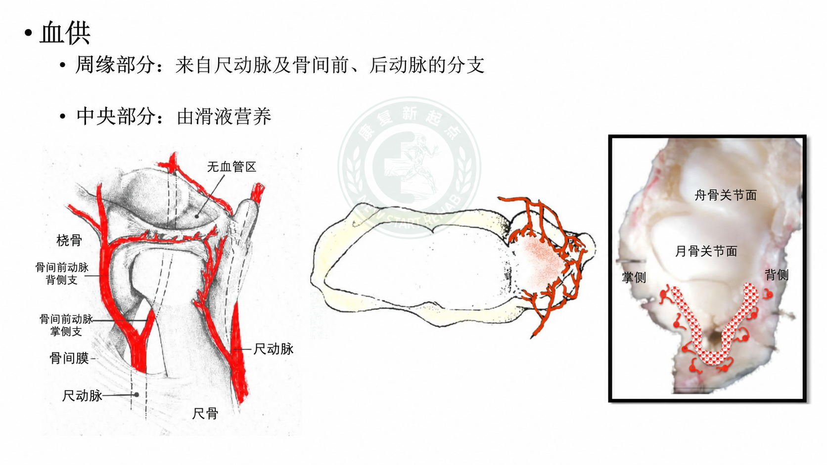 TFCC 血供图